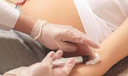 Dự phòng một số bệnh nhiễm virút ở trẻ sơ sinh