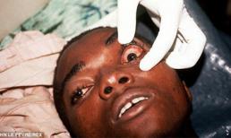 Thái Lan phát hiện 21 du khách nghi nhiễm Ebola