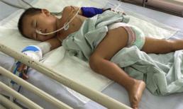 Bé 2 tuổi ngã chấn thương sọ não, cô giáo nói do không để ý?