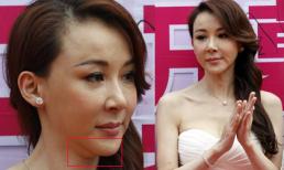 'Đệ nhất mỹ nhân xứ Đài' một thời lộ hai cằm vì lạm dụng 'dao kéo'