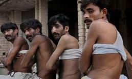 Lật tẩy những đường dây buôn nội tạng khét tiếng thế giới