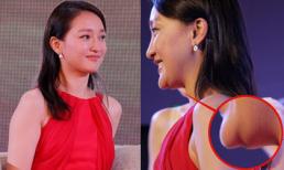 Châu Tấn lộ cằm lồi lõm dị dạng