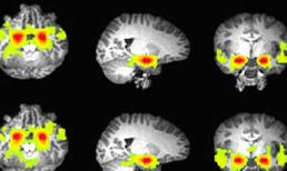 Hé lộ bí mật của bộ não thanh thiếu niên hư