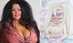 Chi hơn 4 tỷ đồng chỉ để phẫu thuật giống... chân dung biếm họa