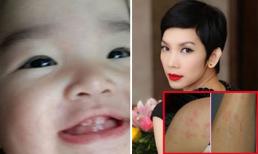 Xuân Lan 'khổ sở' vì bị con gái cắn khắp người