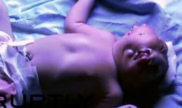 Bé sơ sinh Ấn Độ có 2 khuôn mặt trên một đầu