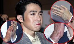 Du Hạo Minh F4 trong vụ bỏng cùng Selina tái xuất với tay đầy sẹo biến dạng