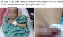Bé trai bị khoan vào vùng kín: Người 'lỡ tay' khoan nói gì?