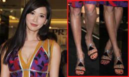 Lâm Chí Linh lộ chân gân guốc, loang lổ như bị 'nấm'