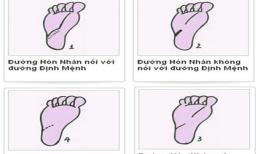 Bí mật đường hôn nhân ở lòng bàn chân