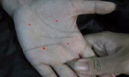 Bí mật nốt ruồi trên bàn tay