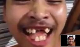 Chàng trai có hàm răng kì lạ