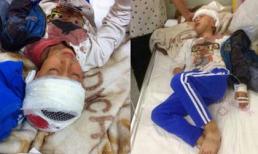 Không biết vẽ, 4 học sinh bị thầy giáo đánh đập dã man