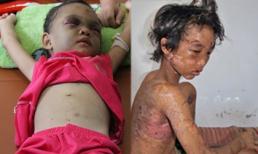 Những vụ bạo hành trẻ gây chấn động dư luận