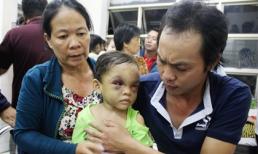 Cha đẻ và bà ngoại giành quyền nuôi bé 4 tuổi bị bạo hành