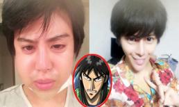 Giật mình trước nhan sắc thẩm mỹ quá đà của chàng trai Nhật