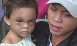 Cha ruột bé 4 tuổi bị đánh trình giấy khai sinh bản gốc