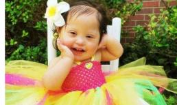 Cô bé bị down hát nhép thật hồn nhiên