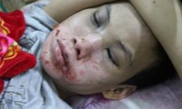 Truy bắt kẻ hành hạ dã man bé trai khuyết tật trong khách sạn