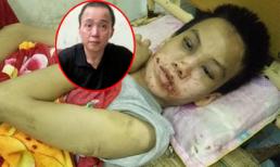 Bắt nghi can hành hạ bé trai 14 tuổi ở khách sạn