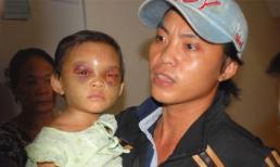 Bé 4 tuổi bị bạo hành: Bố ruột vui vẻ đợi kết quả ADN