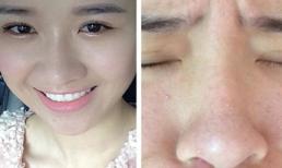 “Hot girl Ngọc Anh Anh” bị đe dọa tính mạng khi dùng mỹ phẩm rởm