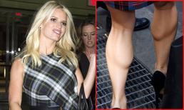 Jessica Simpson lộ bắp chân lồi lõm xấu xí