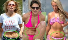 "Hãi hùng" với những màn "khoe" vòng 2 nhăn nhúm của sao