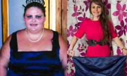 Cô gái béo phì giảm 76kg một cách đáng kinh ngạc