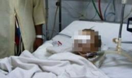 Bé gái 13 tháng tuổi nứt sọ não sau khi đi nhà trẻ