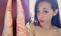 Cô nàng 9X rạch chân đòi quà bạn trai gây sốc