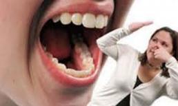 Xử lý chứng hôi miệng