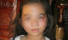 Bé gái tử vong sau trận đòn tra tấn của bố
