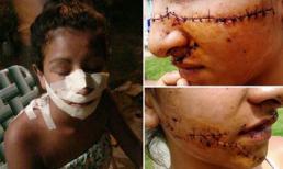 Nữ sinh bị rạch mặt vì... quá xinh đẹp