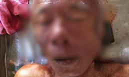 Truy tìm tung tích nạn nhân bị vứt xác lề đường