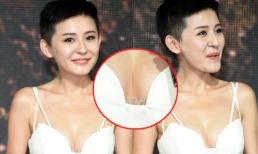 Mỹ nhân 'Chân Hoàn truyện' lộ dấu vết nghi thẩm mỹ vòng một