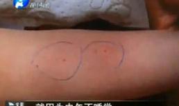 Không ngủ trưa, bé 3 tuổi bị cô giáo mầm non chọc kim vào người