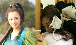 Sao Hoa ngữ bị khâu hơn 20 mũi vì tai nạn trên phim trường