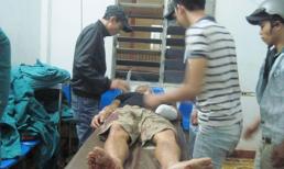 Người dân nhặt bàn tay thanh niên bị chém đứt đi cấp cứu