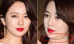 Yoon Eun Hye lộ cằm béo chảy xệ