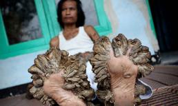 Những 'quái nhân' nửa người nửa vật