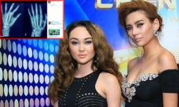 Siêu mẫu Võ Hoàng Yến bị tố làm gãy tay đồng nghiệp