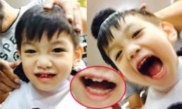 Subeo khoe răng sún cực yêu trong lúc cắt tóc