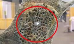 Sự thật đằng sau những chiếc lỗ