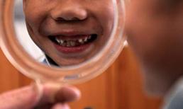 Bảo vệ răng miệng cho trẻ ở trường học