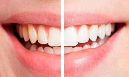 6 mẹo thiên nhiên giúp hàm răng trắng như ngọc