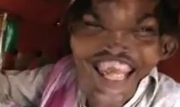 Bí ẩn người đàn ông mang khuôn mặt quỷ