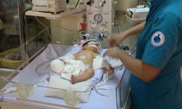 Vết thương của bé sơ sinh bị văng khỏi bụng mẹ đang nhiễm trùng nghiêm trọng