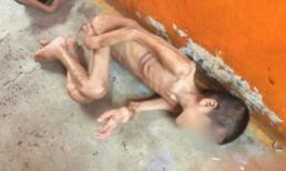 Bàng hoàng bức ảnh cậu bé gầy giơ xương nằm co ro trên đất