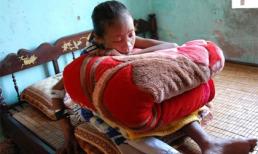 Cô gái 10 năm ôm gối ngủ ngồi